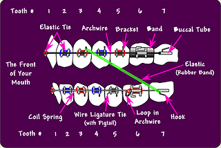 Simple introduction of the orthodontic products