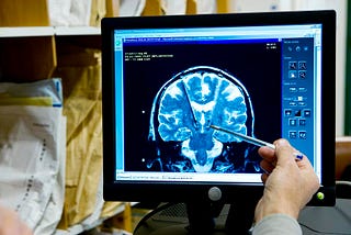 The Brain Technology Treating Neurological Disorders That Will Benefit From AI