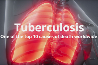 Ending Tuberculosis
