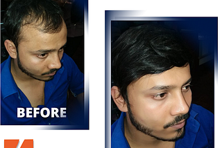 hair extensions for men