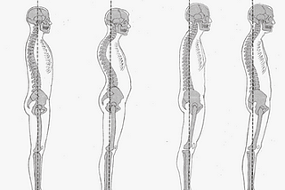 Posture and Neck pain. Are they truly related to each other ?