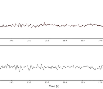 Dynamic plot of Fp2 and C3 channels