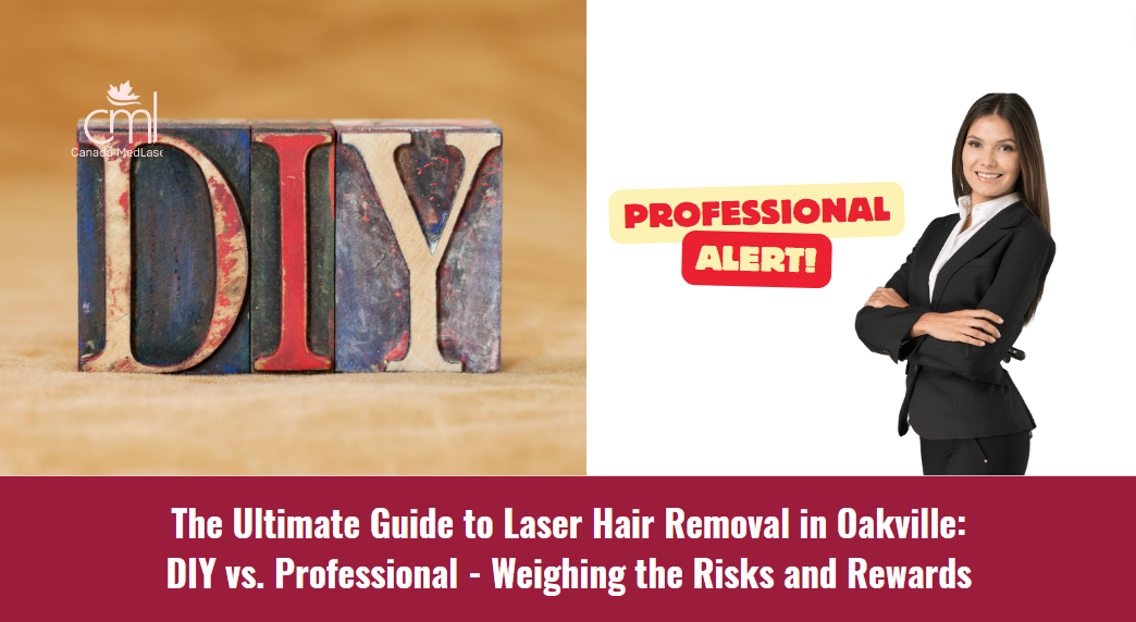 The Ultimate Guide to Laser Hair Removal in Oakville by