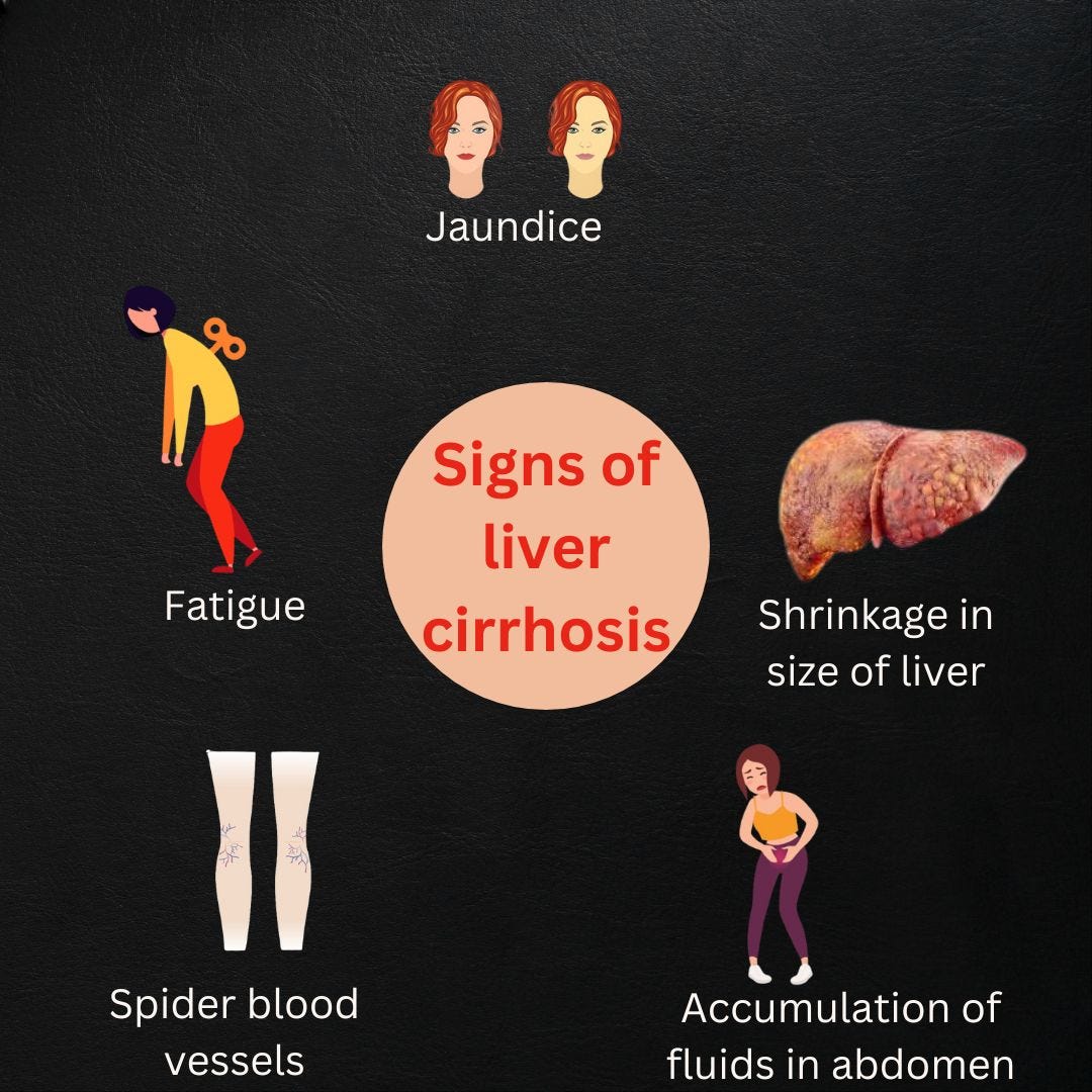 Liver cirrhosis is a condition in which your liver is deeply damaged by ...