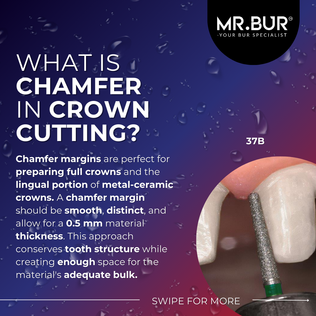 Zirconia Crowns Preparation Guidelines The Dental Insights & Practical Tips by Mr Bur May