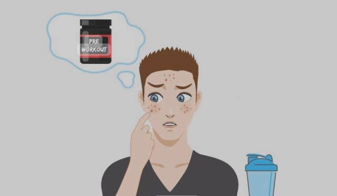 Does PreWorkout Cause Acne?. Deciphering the Connection by Athar