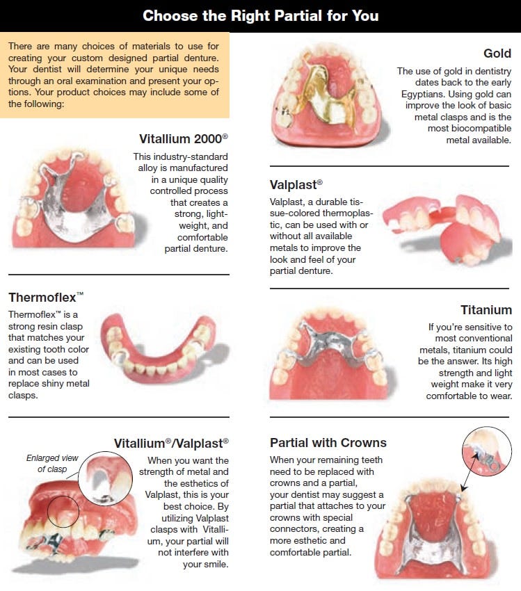Collection 28+ Pictures upper different types of partial dentures ...