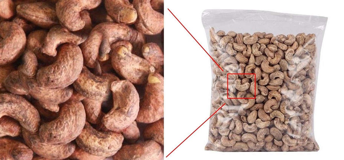 Can Cashew Nuts Cause Acne?. Does cashew cause acne? Do cashew nuts
