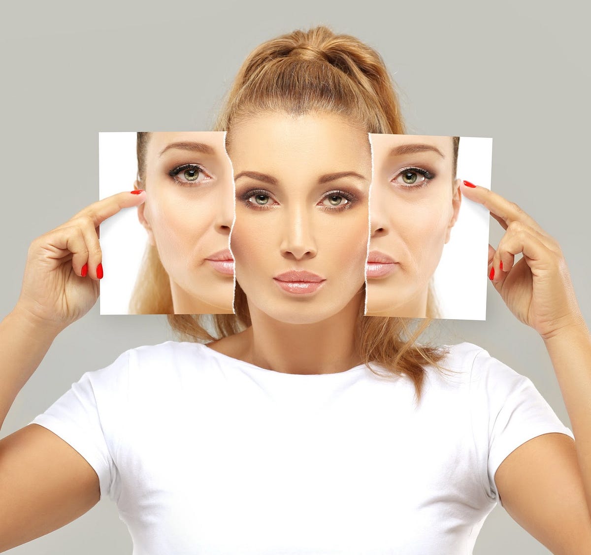 Beware of Bad Smile Lines Filler Risks and Remedies by