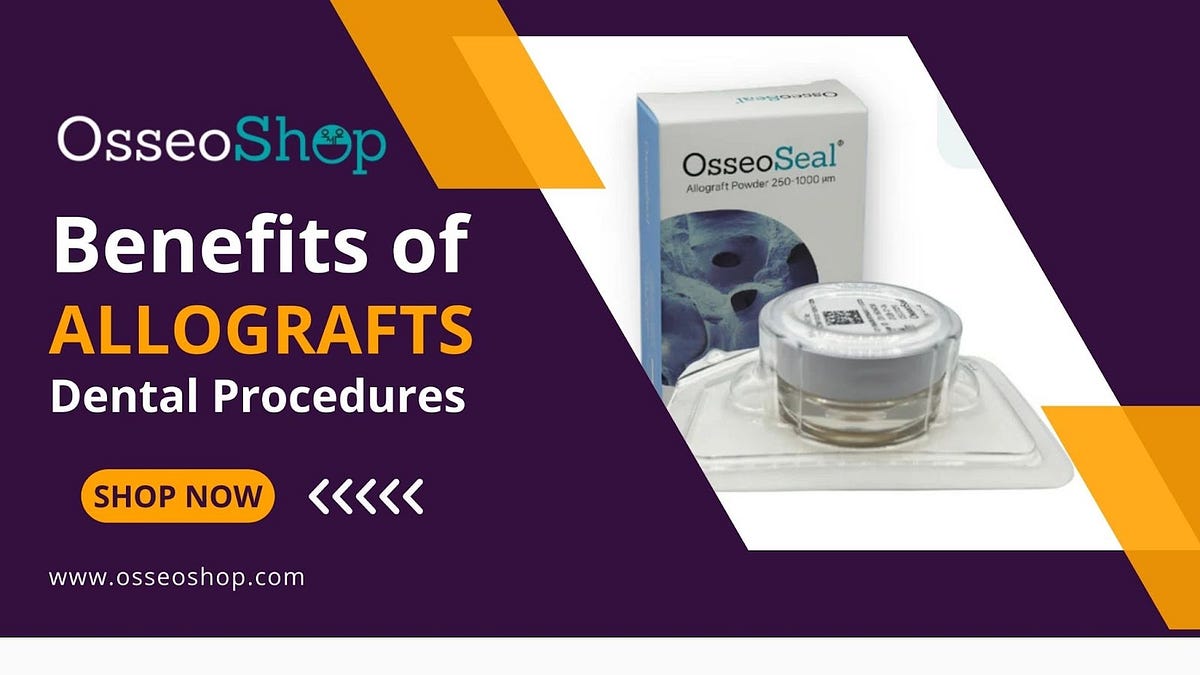 What Are the Benefits of Allografts in Dental Procedures? | by Osseo ...