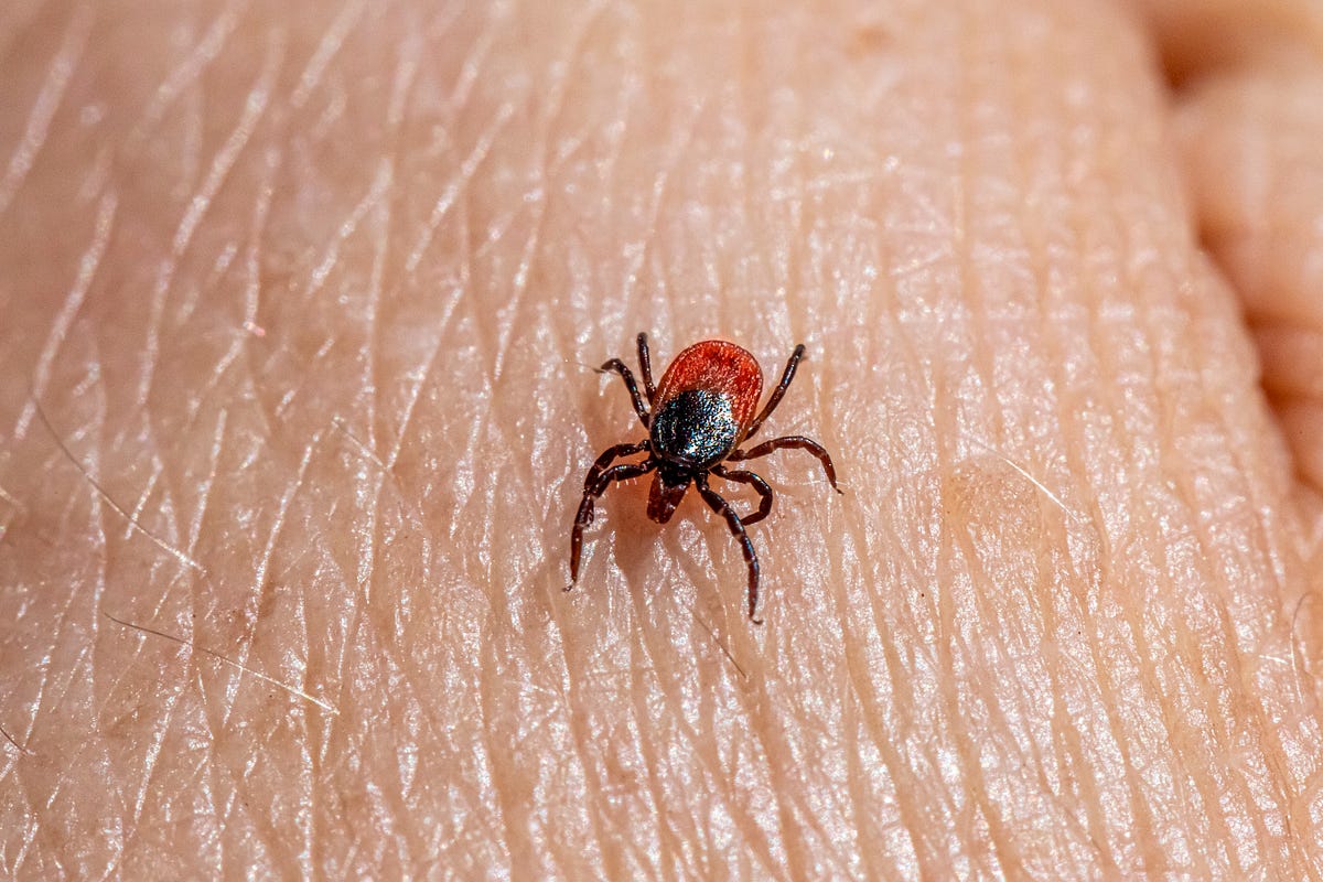Lyme Disease and Hair Loss What You Need to Know and How to Treat It