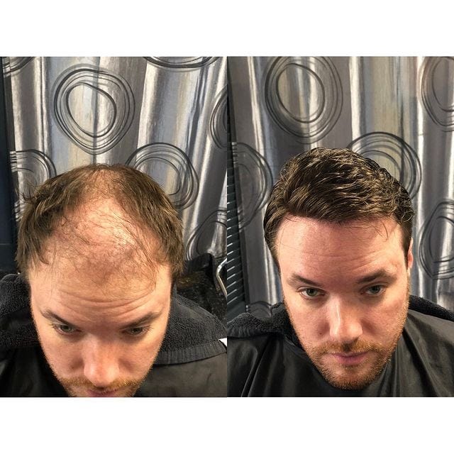 Pros And Cons of Weight Loss Surgery Reddit Unveiled Insights by Abby Poole Jun, 2024 Medium