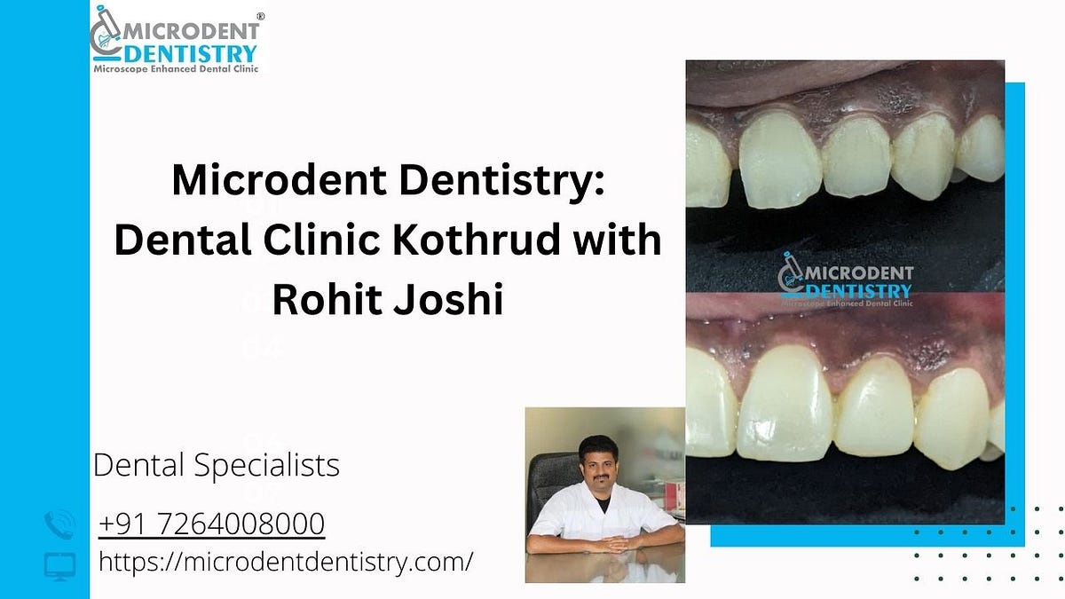 Microdent Dentistry Dental Clinic Kothrud Rohit Joshi by Microdent Dentistry Mar, 2024