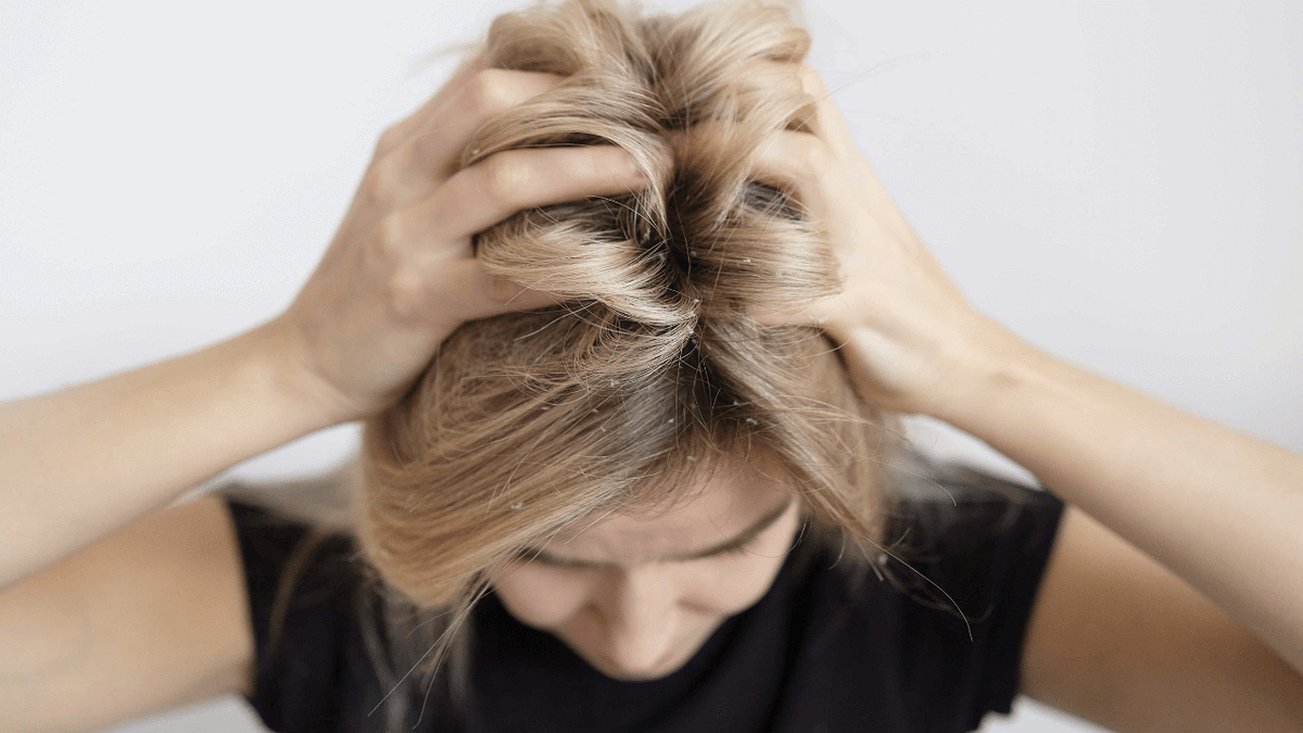Why Does My Scalp Itch at Night — Symptoms, Causes, Remedy by Clara