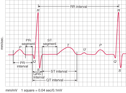 Arrhythmias heart beat classification using deep learning with Keras ...