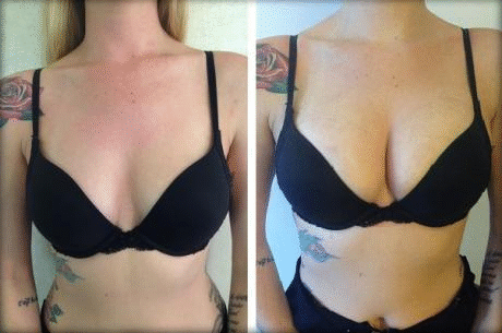 Boobs Growth Diary #7: Wardrobe Cleaning After a Natural Breast