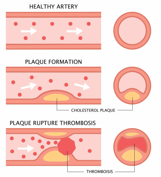 Should You Fast Before a Cholesterol Test? by Amar Gund Medium