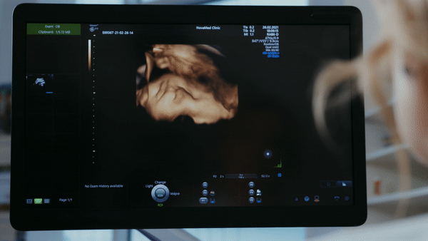 The best Python Libraries for Medical Imaging | by Mohammed El Amine ...
