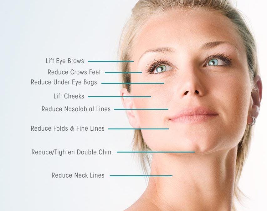 The Thread Lift Effect Embracing a Refreshed and Renewed You by