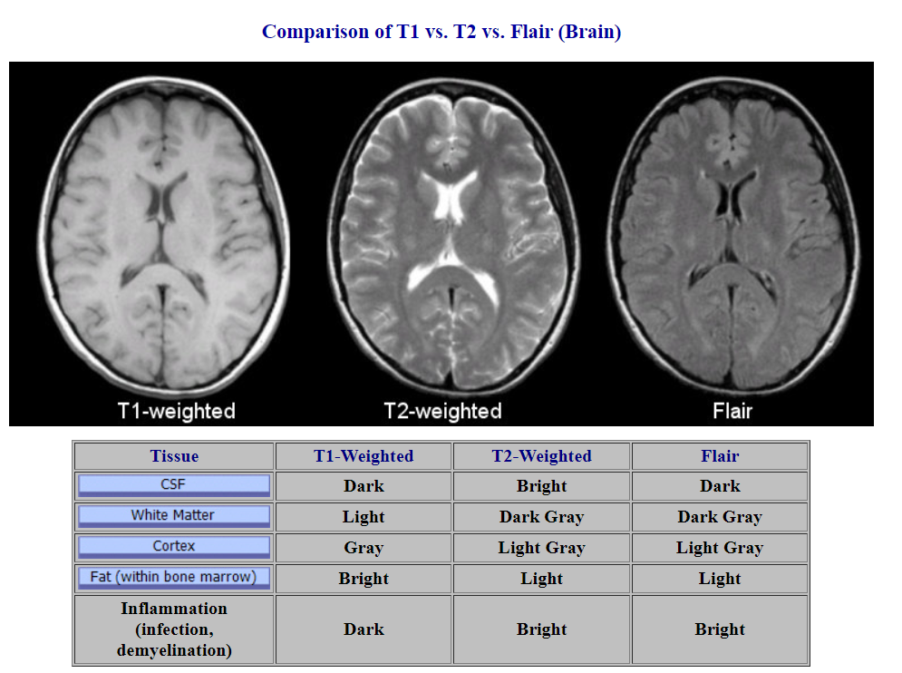 MRI Ready Reference Series Part 2 by Ameiy Acharya Medium