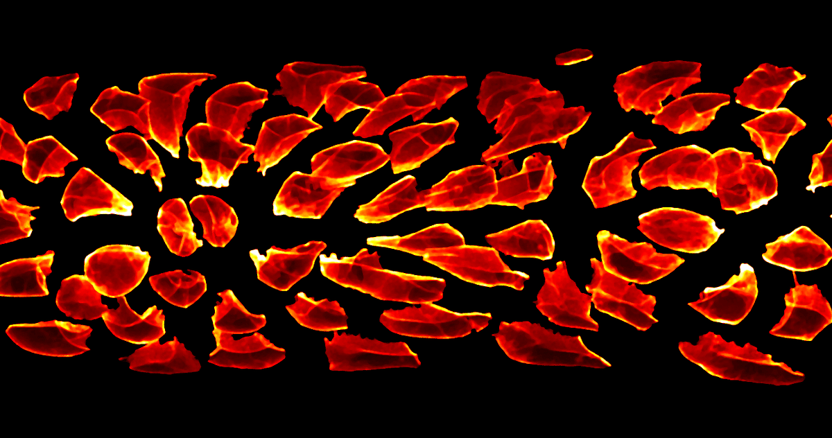 Untangling Biology with Microscopes and Algorithms | by Jonas Hartmann ...