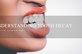 Understanding Tooth Decay | Martin Urban DDS