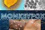 Understanding Mpox: Key Information for Protecting Global Public Health