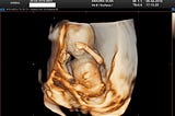 Everything You Want To Know About 3d 4d Ultrasound in Melbourne