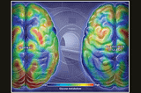 Alzheimer’s disease and glucose metabolism