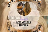 Alopecia-Friendly Wigs & Toppers for a Natural Appearance
