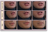 A 3 by 3 grid showing results of this method on a section of silence. The columns represent a sequence of frames over time. The top row shows the real video. The middle row shows Wav2Lip. It has obvious artefacts and the lips are moving. The bottom row is this paper. It looks much higher quality and the lips are shut, this is good because the image is meant to be showing silence.