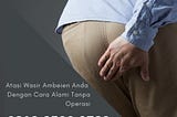 cara menyembuhkan wasir external