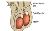 No Needle No Scalpel Vasectomy | Melbourne | Mornington Peninsula | Rosebud Super Clinic