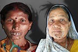 What Is The Witches Of Jharkhand Case: Tortured, Stripped Naked And Beaten To Death