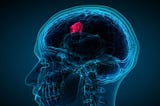 Brain Tumor Segmentation using Deep Learning models