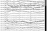 EEG Signal Analysis With Python