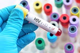 Tips & trik untuk mengatasi penyakit HIV secara alami dan aman