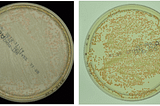 Recognition and Counting of Microorganisms on Petri Dishes