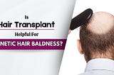 Is-Hair-Transplant-Helpful-For-Genetic-Hair-Baldness-min.jpg