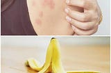 12 DIY Home Remedies For Bug Bites — DIY Bug Bites Home Remedy!