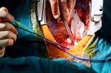 Applications for Video-Assisted Minimally Thoracic Surgery