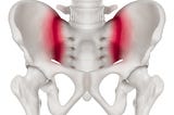 The lower back pain secret: Sacroiliac Joint Instability
