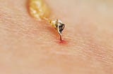 Bee Venom Therapy as a Treatment for Lameness in Horses