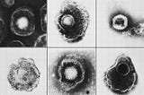 The Problem With Subclinical Herpesvirus Reactivations Throughout Life