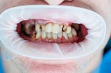 This image is about the symptoms of poor oral health