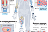 Prelude to a new era of bionics