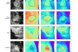 Compositional heat map for cancerous and non-cancerous breast lesion types. Redder colors indicate thicker regions while bluer regions represent thinner or no thickness.