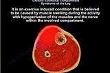 Chronic Exertional Compartment Syndrome