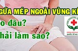 Tìm hiểu nguyên nhân và cách chữa trị ngứa 2 bên mép vùng kín