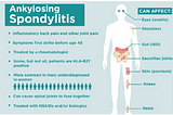 https://www.numpyninja.com/post/ankylosing-spondylitis-as